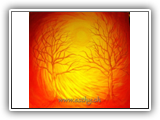 Longing NFS 100x100cm